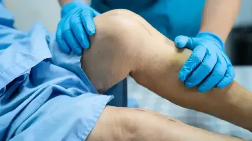How Much Does a Knee Replacement Surgery Cost in Mumbai?